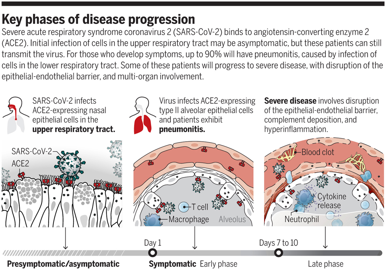 Covid-19-infection.jpg